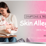 Common skin allergy child treatment | Baby Skin Care Allergies